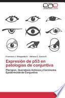 libro Expresión De P53 En Patologías De Conjuntiva